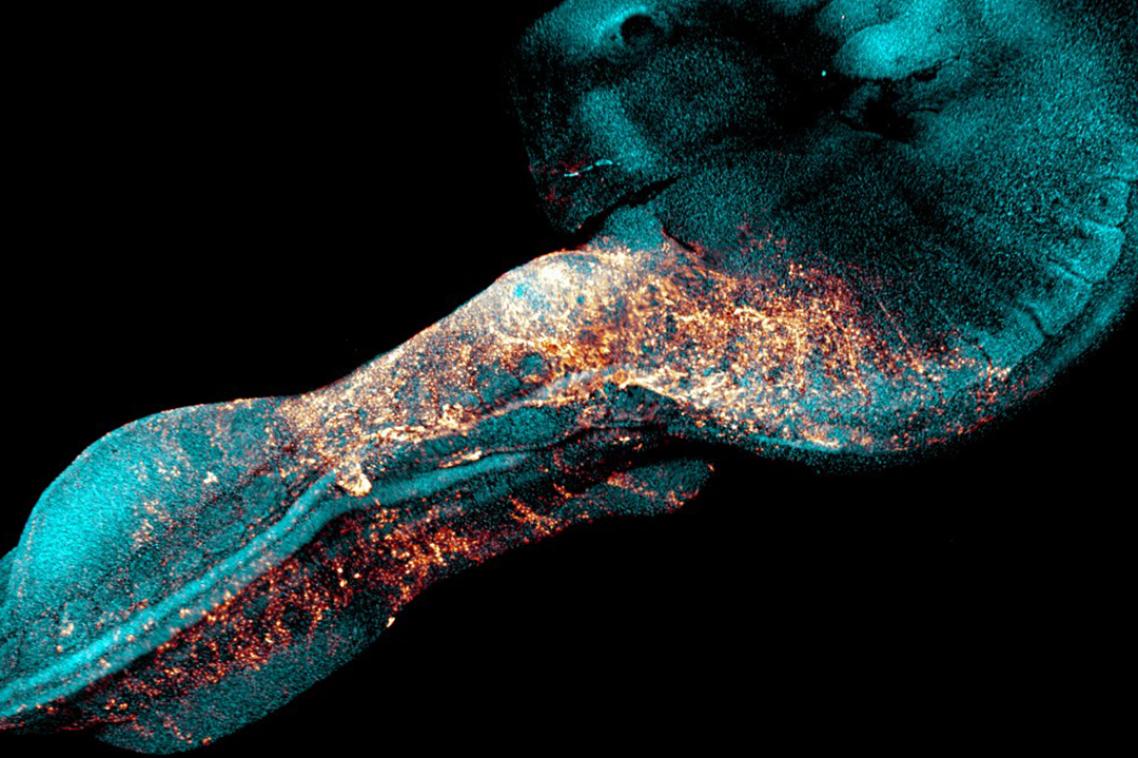 Microscopic image of Junctional neural tube defect caused by Prickle1 disruption