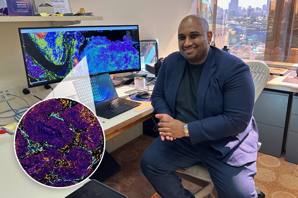 Associate Professor Arutha Kulasinghe at his desk in front of a computer screen with a scan of a non-small cell lung cancer on the screen.