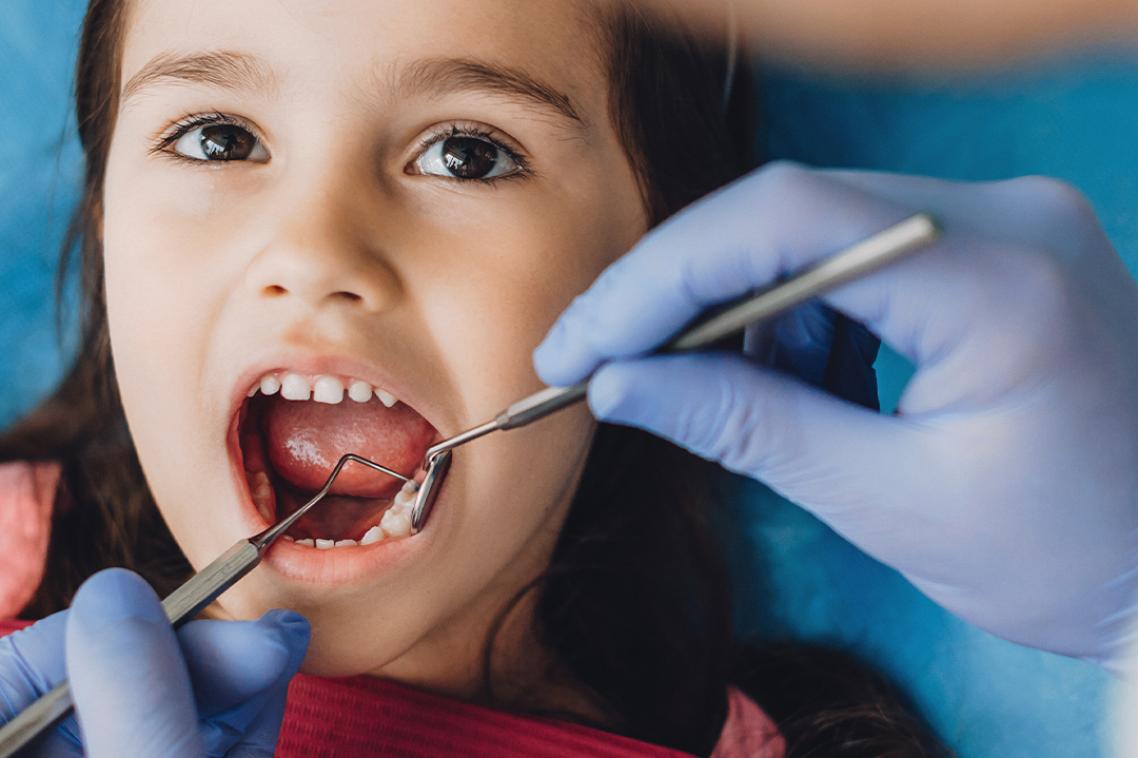 Child with mouth open while dentist inspects teeth.